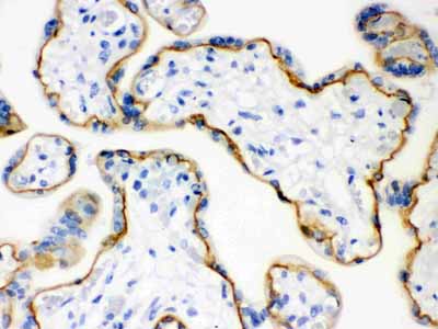 2 - Anti-E-Cadherin Antibody ABO12248