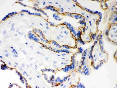 2 - Anti-E-Cadherin Antibody ABO12248