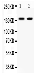 1 - Anti-E-Cadherin Antibody ABO12248