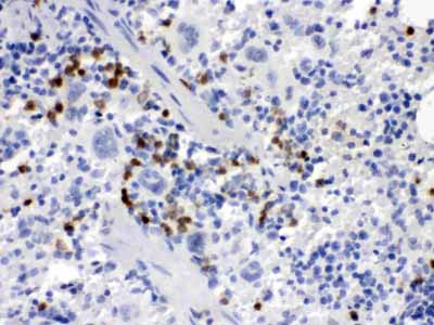 2 - Anti-M-CSF Antibody ABO12249