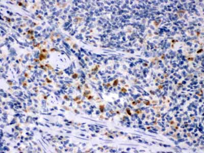 2 - Anti-M-CSF Antibody ABO12249