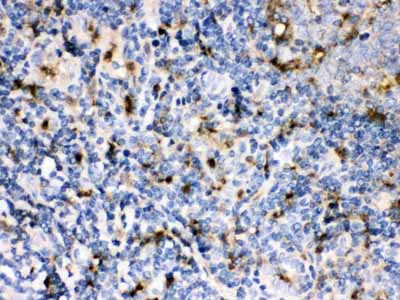2 - Anti-Cystatin A Picoband Antibody ABO12251