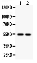 1 - Anti-Cystatin A Picoband Antibody ABO12251