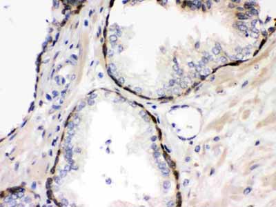 2 - Anti-Cystatin B Antibody ABO12252