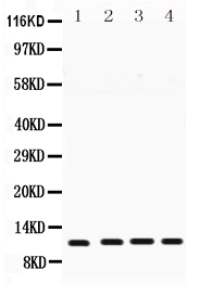 1 - Anti-Cystatin B Antibody ABO12252