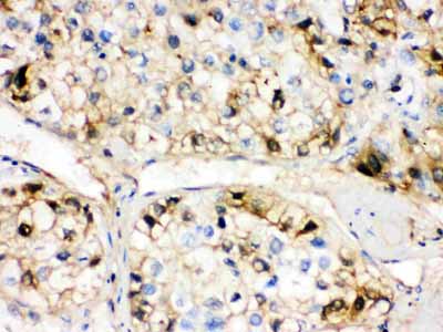 2 - Anti-Fetuin A Antibody ABO12254