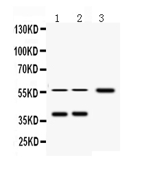 1 - Anti-Fetuin A Antibody ABO12254