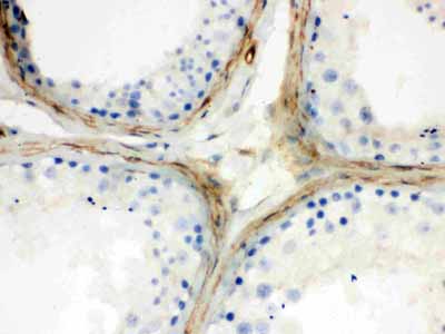 2 - Anti-Clusterin Antibody ABO12261