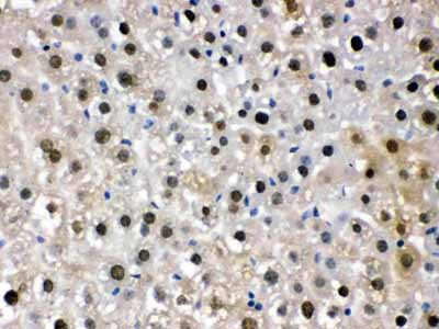 2 - Anti-DDB1 Picoband Antibody ABO12264