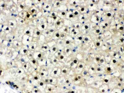 2 - Anti-DDB1 Picoband Antibody ABO12264