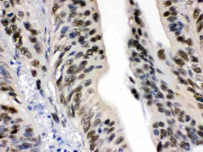 2 - Anti-DDB1 Picoband Antibody ABO12264
