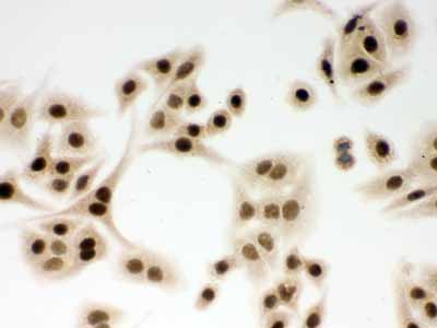 2 - Anti-DDB1 Picoband Antibody ABO12264