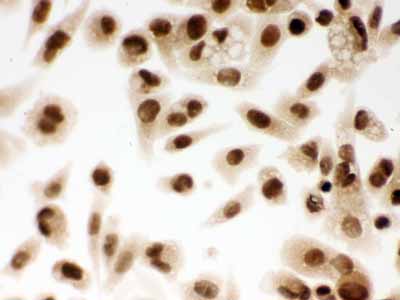 2 - Anti-DDB1 Picoband Antibody ABO12264