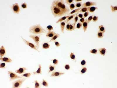 2 - Anti-DDB1 Picoband Antibody ABO12264