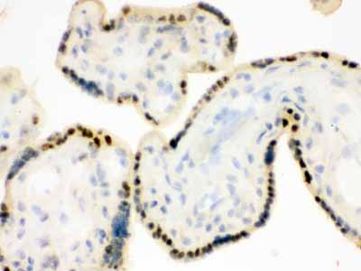 2 - Anti-DDB1 Picoband Antibody ABO12264