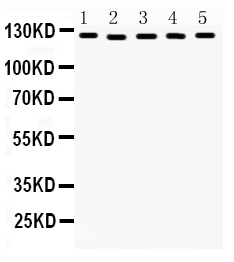 1 - Anti-DDB1 Picoband Antibody ABO12264