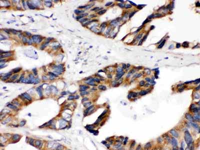 2 - Anti-DLD Picoband Antibody ABO12265