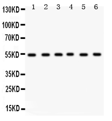 1 - Anti-DLD Picoband Antibody ABO12265
