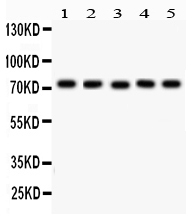 1 - Anti-EED Picoband Antibody ABO12267