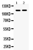1 - Anti-Eph Receptor A5 Picoband Antibody ABO12269