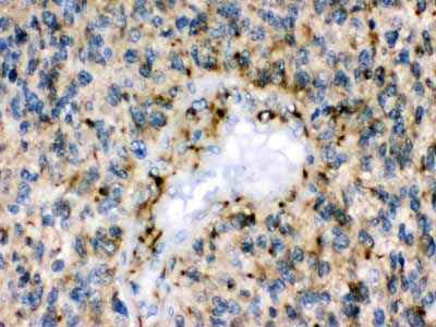2 - Anti-Eph Receptor B1 Picoband Antibody ABO12270