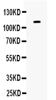 1 - Anti-Eph Receptor B1 Picoband Antibody ABO12270