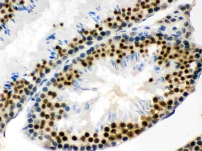 2 - Anti-EWSR1 Picoband Antibody ABO12271