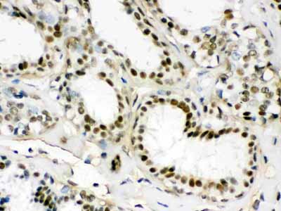 2 - Anti-EWSR1 Picoband Antibody ABO12271