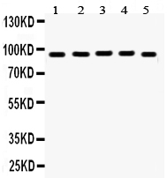1 - Anti-EWSR1 Picoband Antibody ABO12271