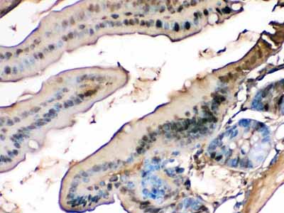 2 - Anti-liver FABP Picoband Antibody ABO12272