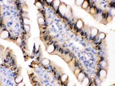 2 - Anti-liver FABP Picoband Antibody ABO12272