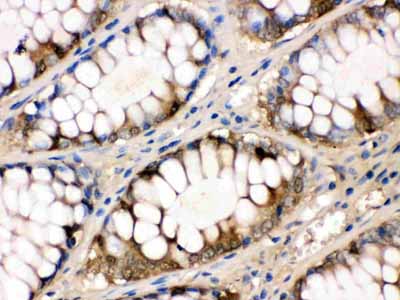2 - Anti-liver FABP Picoband Antibody ABO12272