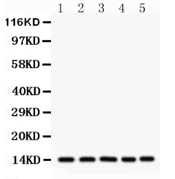 1 - Anti-liver FABP Picoband Antibody ABO12272