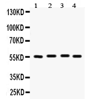 1 - Anti-Fascin Picoband Antibody ABO12278