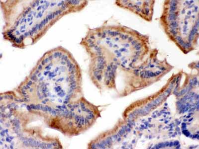 2 - Anti-FUT1 Picoband Antibody ABO12279