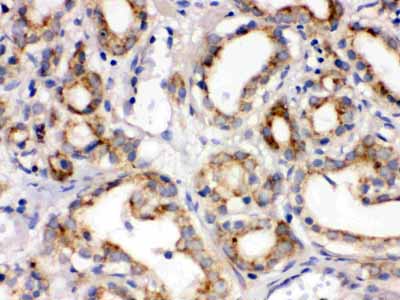 2 - Anti-Frizzled Homolog 1 Picoband Antibody ABO12280