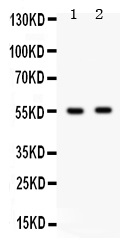 1 - Anti-GABRB3 Picoband Antibody ABO12281