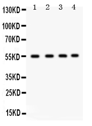 1 - Anti-GJA3 Picoband Antibody ABO12282