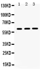 1 - Anti-HNF1 Beta Picoband Antibody ABO12283