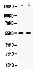 1 - Anti-5HT2B Receptor Picoband Antibody ABO12286