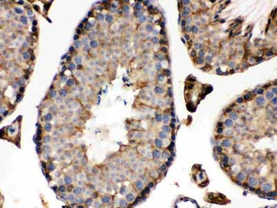 2 - Anti-IDH1 Picoband Antibody ABO12287