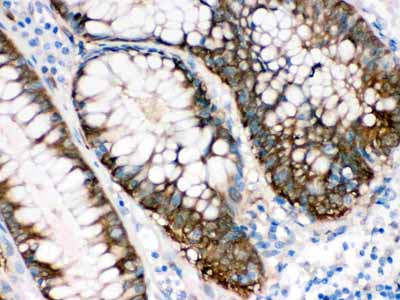 2 - Anti-IDH1 Picoband Antibody ABO12287