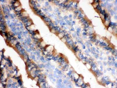 2 - Anti-IDH1 Picoband Antibody ABO12287