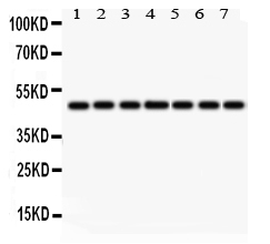 1 - Anti-IDH1 Picoband Antibody ABO12287