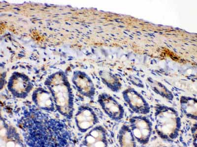 2 - Anti-IDH2 Picoband Antibody ABO12288