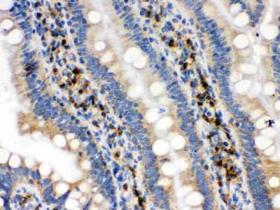 2 - Anti-IDH2 Picoband Antibody ABO12288