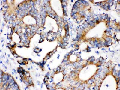2 - Anti-IDH2 Picoband Antibody ABO12288
