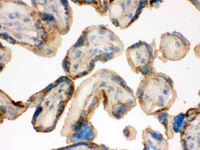2 - Anti-IDH2 Picoband Antibody ABO12288