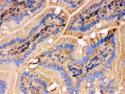 2 - Anti-IDH2 Picoband Antibody ABO12288