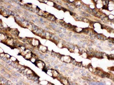 2 - Anti-IDH2 Picoband Antibody ABO12288